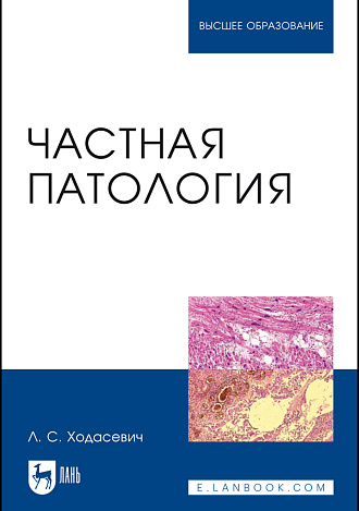 Частная патология, Ходасевич Л. С., Издательство Лань.